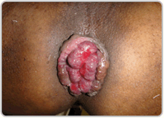 Dr.Kashid Hospital & Piles Clinic